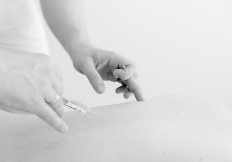 Dr-Florian-Haselsteiner-Mesotherapie